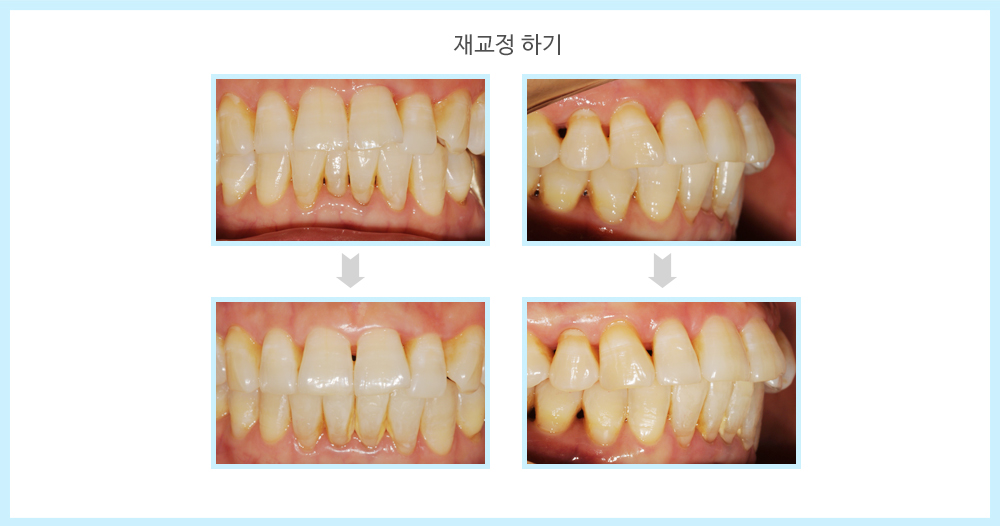 내부이미지
